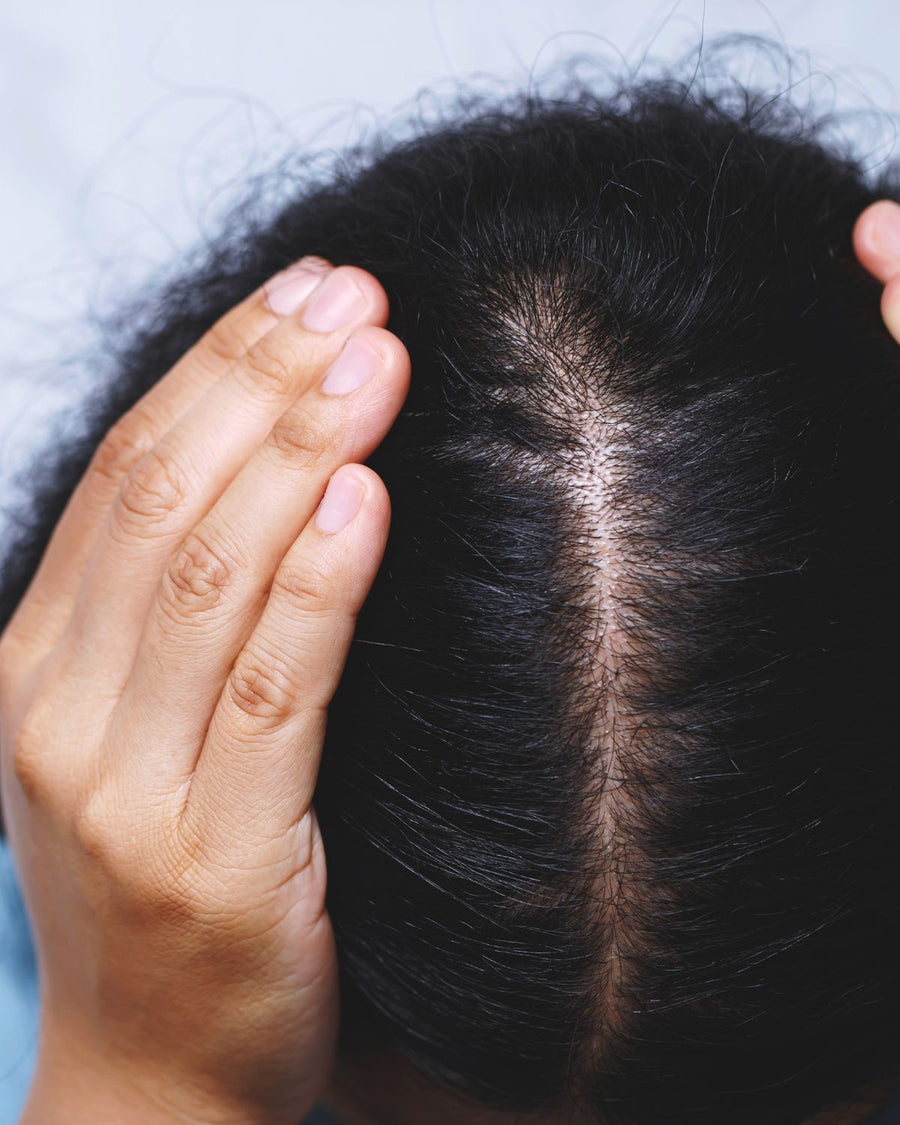 Scalp Care